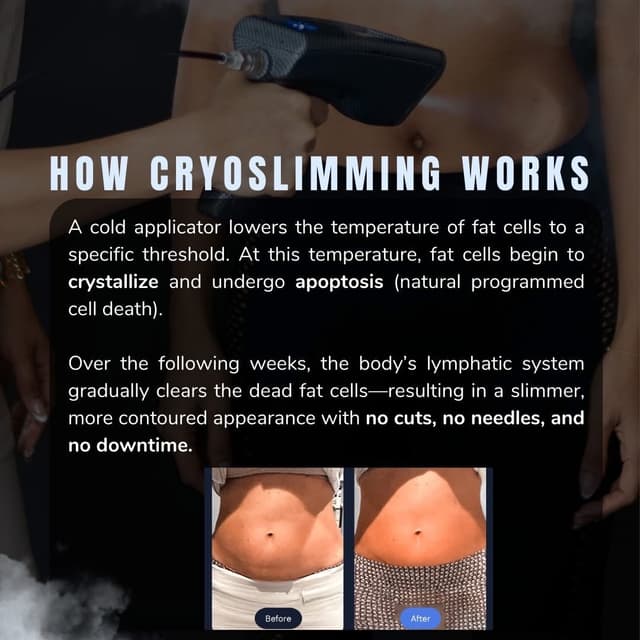 Cryo Slimming 6pk at SheenaSwain in Montrose, CO